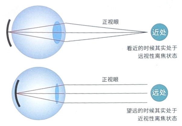 离焦现象.jpg