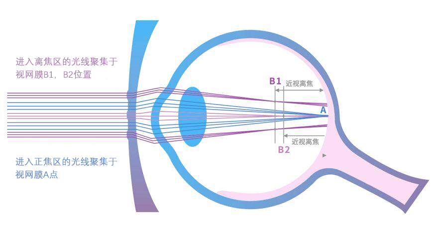 多点离焦宣传册2_02_04-1.jpg